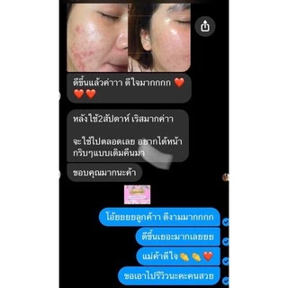 ครีม Lamona ของแท้💯%