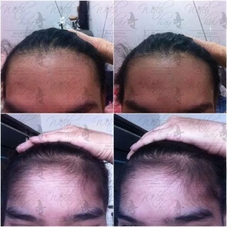 📣Witch Hair เซรั่มปลูกผม คิ้ว หนวด ขวดแรกเห็นผล💯% ขนาด 60ml.