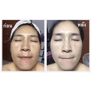 PRINCESS ครีมขมิ้นปริ้นเซส แท้ 100% [รับตรงจากแบรนด์ ] มากดใช้ส่วนลดหน้าไลฟ์ จัดหนักลดเยอะ