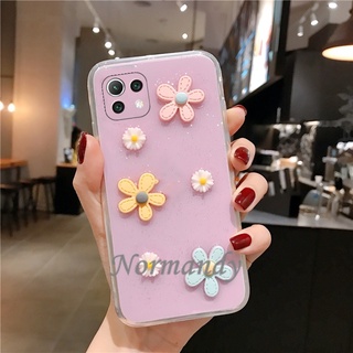 เคส NEW Phone Case Xiaomi 11 Lite 5G NE Mi 11 Lite Mi 11 Ultar Mi 10T Mi 10T Pro Silicone Transparent Casing 3D Sun Flower Soft Case Shockproof Back Cover เคสโทรศัพท์