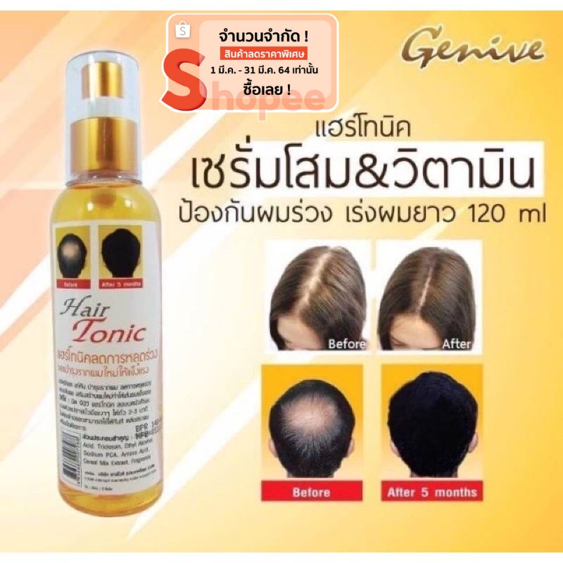 Hair Tonic Genive สเปรย์ปลูกผม ลดการหลุดร่วง(โปรพิเศษสำหรับเดือนนี้🔥)120 ml.