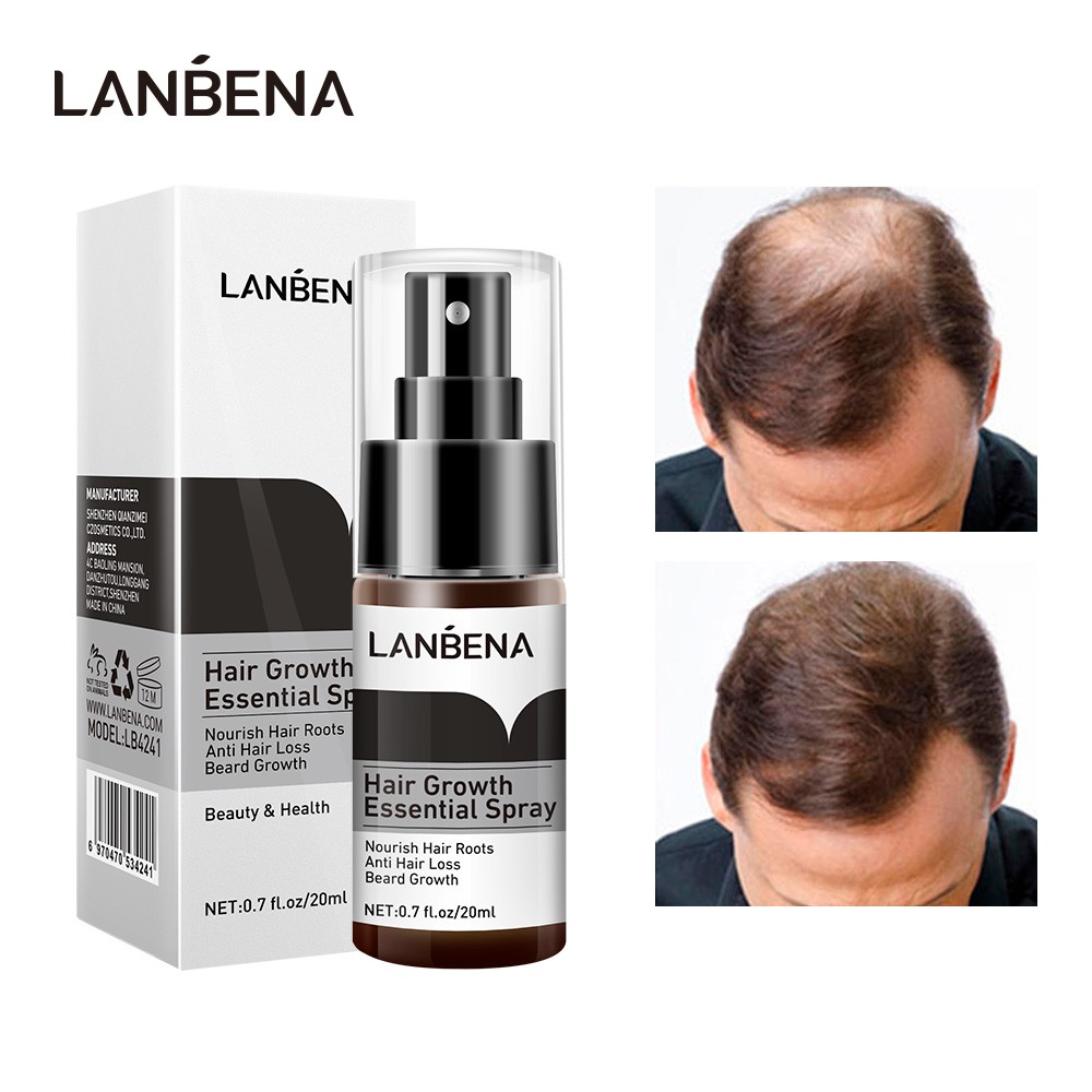 LANBENA Hair Growth Essence Spray สเปรย์เอสเซ้นเจริญเติบโตของเส้นผม