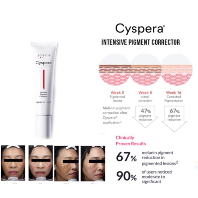 #พร้อมส่ง Cyspera สำหรับดูแลฝ้า