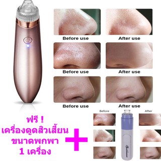 #374+365เครื่องดูดขจัดสิวเสี้ยน กระชับรูขุมขน BLACKHEAD SUCTION DEVICE ฟรี ! เครื่องดูดสิวเสี้ยนขนาดพกพา 1 เครื่อง