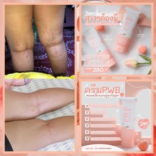 NEW PACKAGE ‼️❤️‍🔥 PWBครีมทาก้น​ ​ #pwb​ รีวิวจากผู้ใช้จริง​ ได้ผล100% ครีมลดรอยจุดด่างดำ ลดรอยแตก