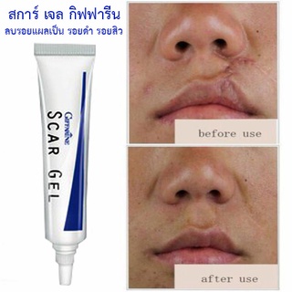 ถูก ดี ของแท้-พร้อมส่ง สการ์ เจลScar Gelเจลลบรอยแผลเป็น รอยดำ รอยสิว/ปริมาณ15กรัม/จำนวน1หลอด/รหัส14005📌dErn