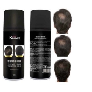 kingyes hair spray สเปรย์ผมไฟเบอร์ ปิดผมขาว ปิดผมบาง แก้ปัญหาหัวล้าน