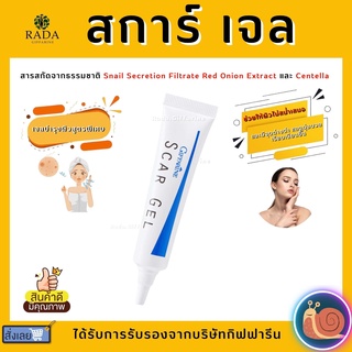 สการ์เจล กิฟฟารีน scargel สกาเจล giffarine รอยสิว รักษาสิว ครีมแต้มสิวอักเสบ รอยแผล รอยแดง รอยดำ