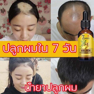 EELHOE เซรั่มปลูกผม 40ML ลดผมร่วง หยุดผมร่วง ฟื้นฟูผม ป้องกันผมร่วง เซรั่มบำรุงผม ยาปลูกผม บำรุงผม น้ำยาใส่ผม