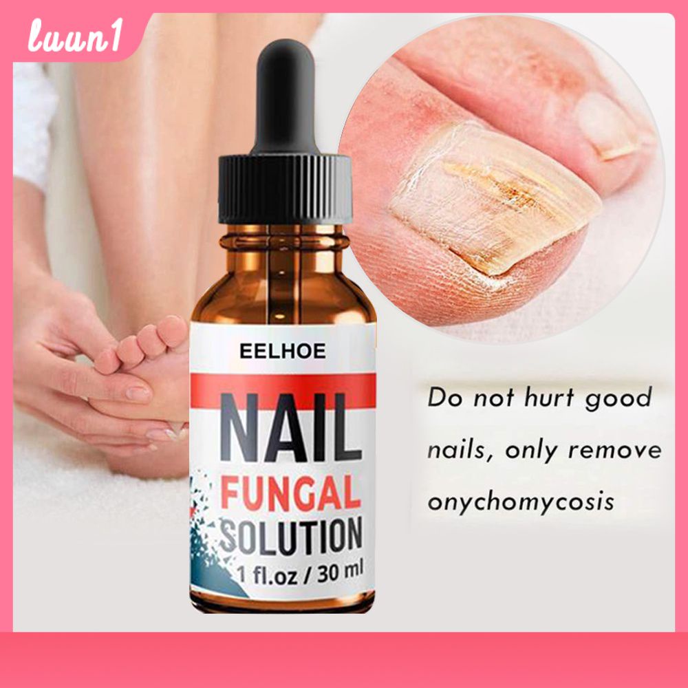 Eelhoe 10/20/30Ml Foot Anti-Fungal Essence To Remove Onychomycosis Repair Treatment Liquid Healthy Nail Care Repair Liquid Cod