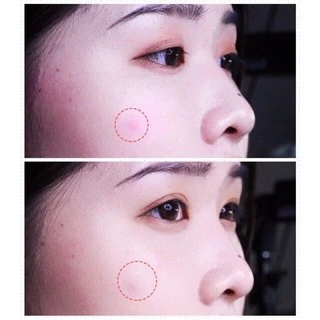 แผ่นแปะสิว ดูดหัวสิว Olive Young Care Plus Spot Patch