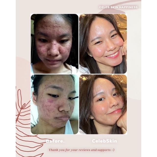 CELEB SKIN HAPPINESS น้ำมันบำรุงผิว Co-Q10 10g รูปที่ 4