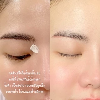หมอมวลชน เซท D ที่กดสิว + Accin Cooling Mud Mask 5 กรัม+ กล่องเก็บที่กดสิว + เจลล้างหน้า ไรฟา 15 ขนาด 7 กรัม