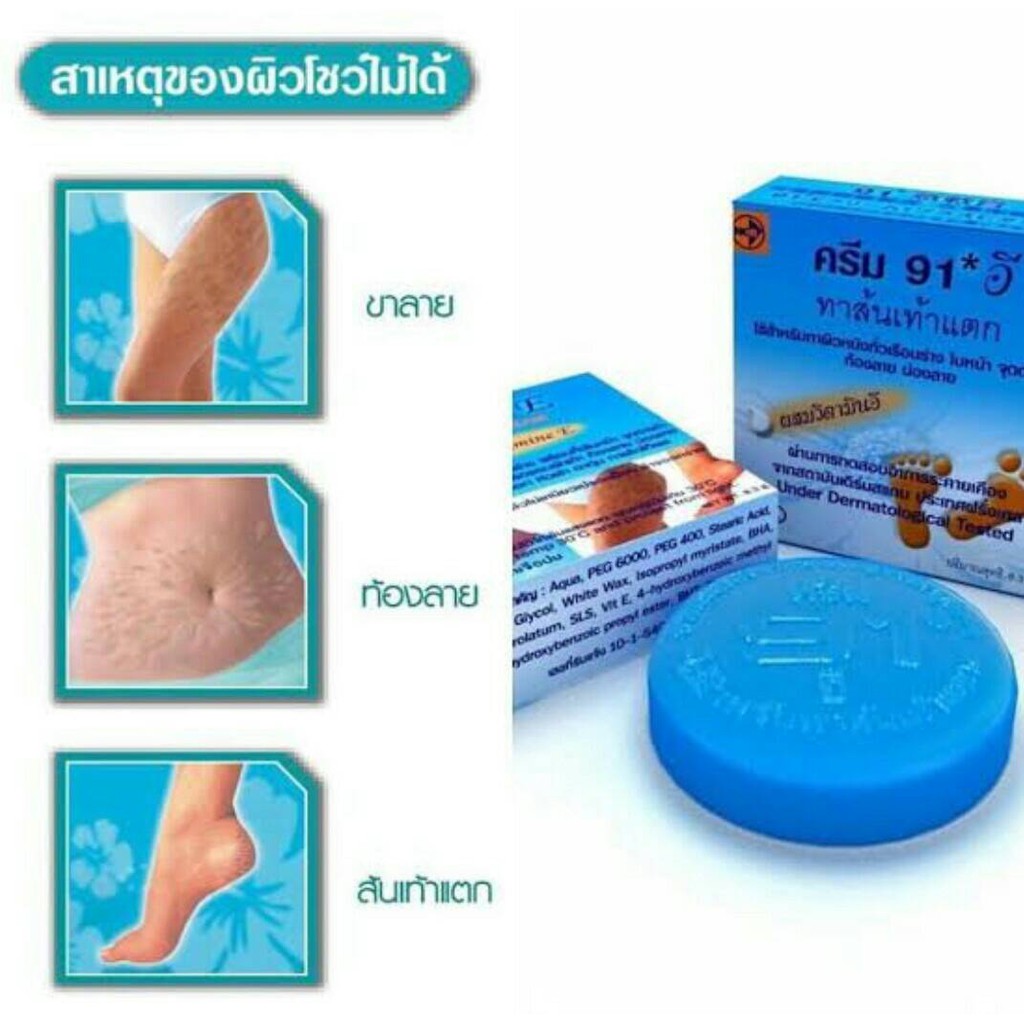 *ครีมทาส้นเท้าแตก ครีม 91 อี 91อี 91E