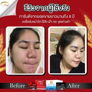 พร้อมส่งแพคเกจใหม่ล่าสุด🔥ครีมโอปิ๊ง O-pingสูตรดั้งเดิมของแท้100% 1 ชุด2ชิ้น