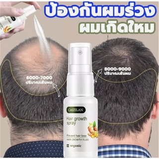 เซรั่มปลูกผม รักษาผมร่วง ฟื้นฟูผมแห้งเสีย แก้ปัญหาผมร่วง ลดผมร่วง บำรุงรากผม ดูแลผม แตกปลาย ป้องกันผมร่วง น้ำยาปลูกผม