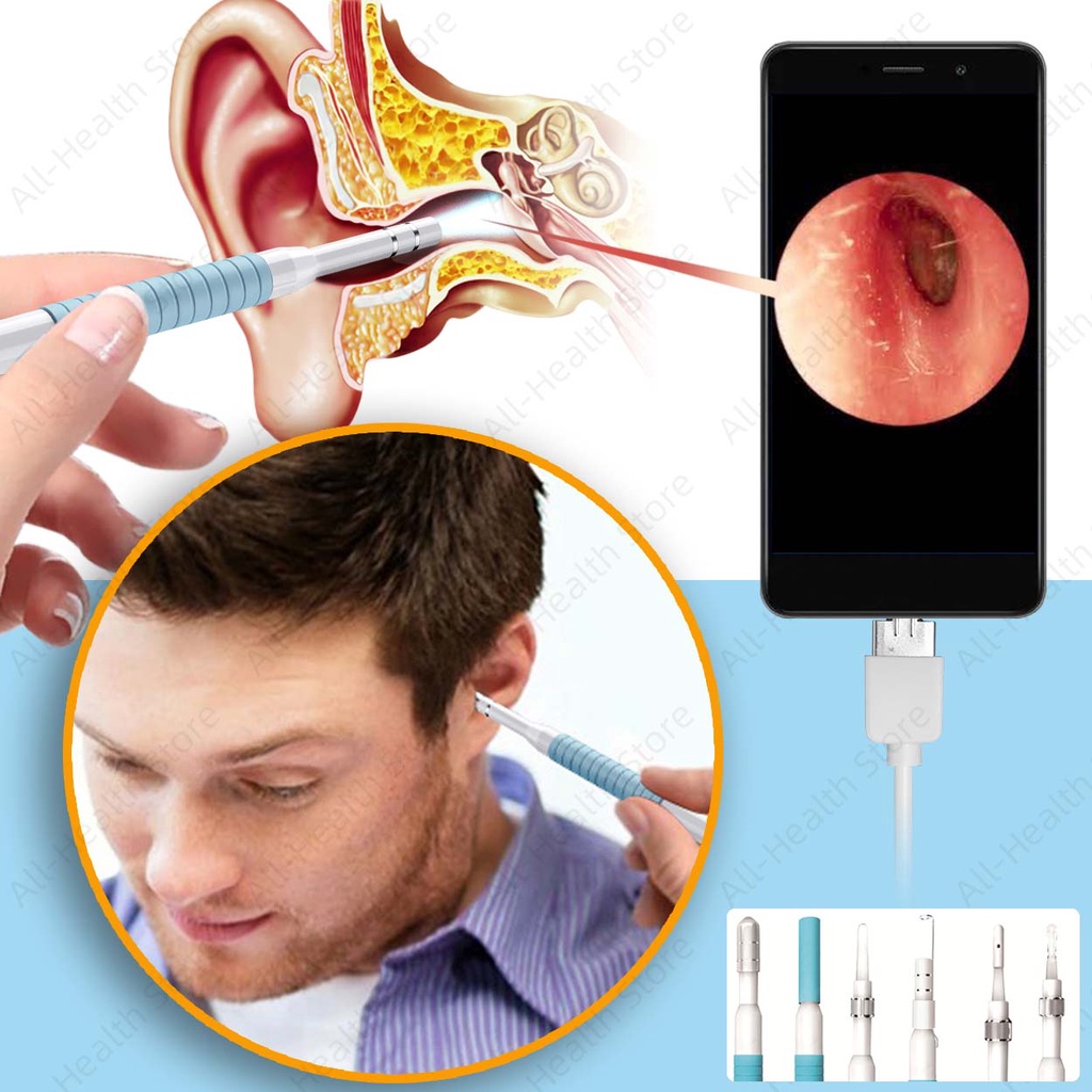 Ear Clear Camera Ear Cleaning Tool Wax Remover Kit Ear Clear Device ...