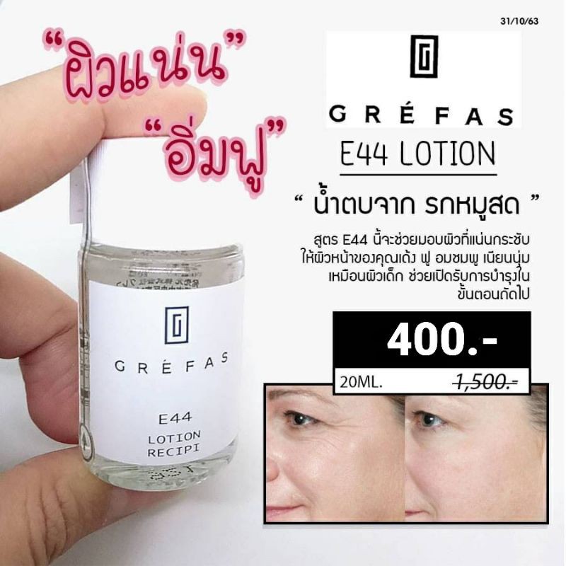 GREFAS E44 Lotion น้ำตบจากรกหมู