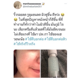 เซรั่มไฮยา หน้าเด็ก หน้าใสเด้ง 1 ขวด 15 มล.ใช้ได้นาน 20-25วัน เซรั่มแฮวอน หน้าใสไร้สิว