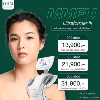 ✨Ultraformer III นวัตกรรมยอดฮิต  💚ยกกระชับ เก็บกรอบ แก้มห้อยคอเหี่ยว จัดการได้