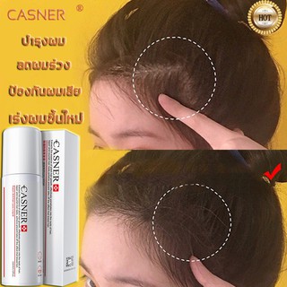 CASNER น้ำยาปลูกผม ปลูกผม น้ำยาเร่งผมยาว เซรั่มปลูกผม น้ำยาปลูกผม เร่งผมขึ้นใหม่ เซรั่มบำรุงผม รักษาผม รักษาผมร่วง