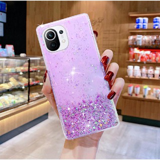 เคสโทรศัพท์มือถือ ลายกลิตเตอร์ สําหรับ Xiaomi Mi 11 Mi 10 Mi 10T Pro Mi 8 Lite MiX3 9SE Xiaomi Poco X3 NFC F2 Pro