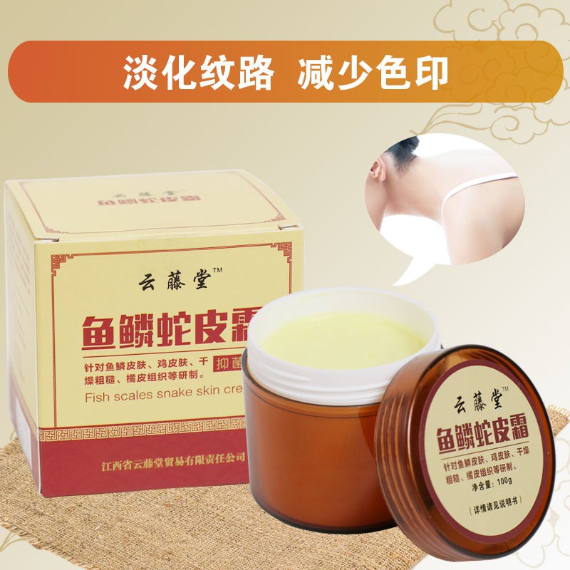 (new)jing fuScale Skin Cream Snake Skin Killer Chicken Skin Hair
