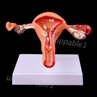 Pathological Uterus Ovary Anatomical Model Anatomy Cross Section Study Tool JZAH