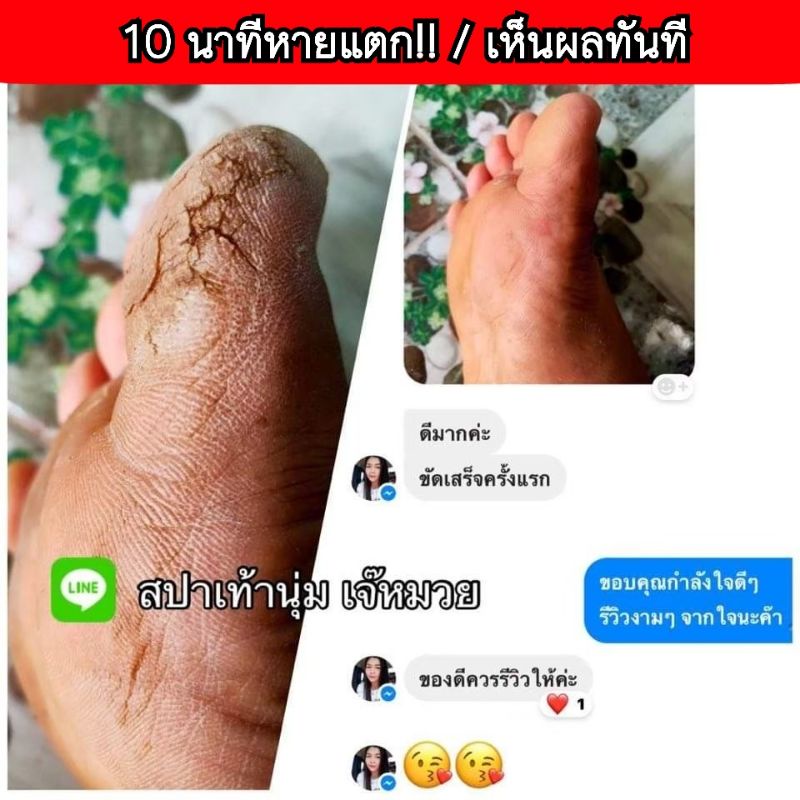 ขายดี น้ำยาขัดส้นแตก ได้ครบชุด (น้ำยา+โฟมขัด+ครีมทาหลังขัด) ส้นแตก เท้าแตก #หายตั้งแต่ครั้งแรกที่ใช้