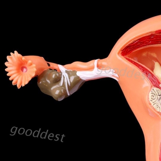 △good▽ Pathological Uterus Ovary Anatomical Model Anatomy Cross Section Study Tool DXWG