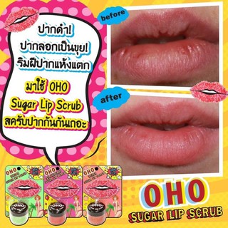 💋มาใหม่....ลิปสครับ OHO Sugar Lip Scrub...👄😻