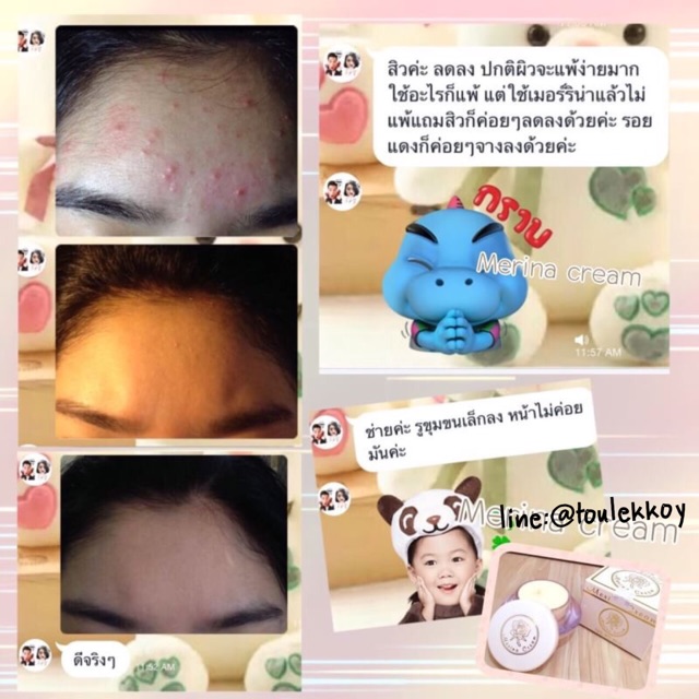 Lot ใหม่!!*พร้อมส่ง^Merina Cream ครีมแก้มบุ๋ม ครีมบำรุงผิวหน้า สูตรอ่อนโยน Merina Cream 4 กรัม