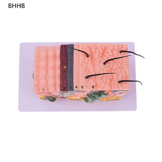 Bhhb 35/50 เท่า โมเดลผิวหนังมนุษย์ โครงสร้างผม ขยายกายวิภาคศาสตร์