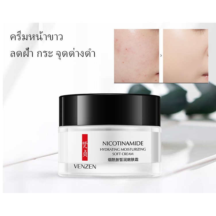 ครีมบำรุงหน้าขาว ลดเลือนฝ้า กระ จุดด่างดำ รอยสิว Venzen Nicotinamide Hydroting Moisturizing Soft Cre