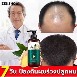 แชมพูแก้ผมร่วง ZENSHOW แชมพูขิง ขิงช่วยป้องกันผมร่วง แชมพูสำหรับลดผมขาดหลุดร่วง ป้องกันผมร่วงบำรุงผม ขิงบำรุงถึงราก 300