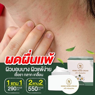 ครีมเคโบ๊ะ สะเก็ดเงิน สังคัง น้ำกัดเท้า เชื้อรา งูสวัด แก้คัน แพ้น้ำ มือแห้ง มือแตกของแท้100 พร้อมส่ง ขนาด20กรัม