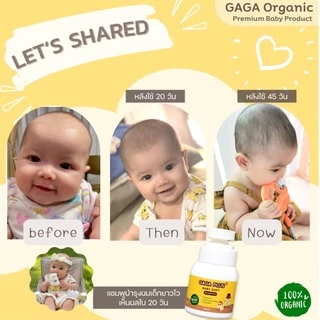 GAGA แชมพูเร่งผมยาวเด็ก โกนผมไฟ🔥ขวดเดียวเห็นผล🔥150มล แชมพูกาก้า gaga organic 100%