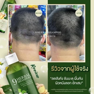 2แถม1 แชมพูโรคผิวหนัง เชื้อราบนหนังศรีษะ รังแค ลอกเป็นขลุย เชื้อรา ชันตุ กลากเกลื้อน ขุนเดช หัวลอก