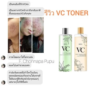 โทนเนอร์ TONER BRYG VC ALOE VERA บริก วีซี ว่านหาง 3in1 เช็ด ตบ มาส์ก VC Premium from Japan +ว่านหาง