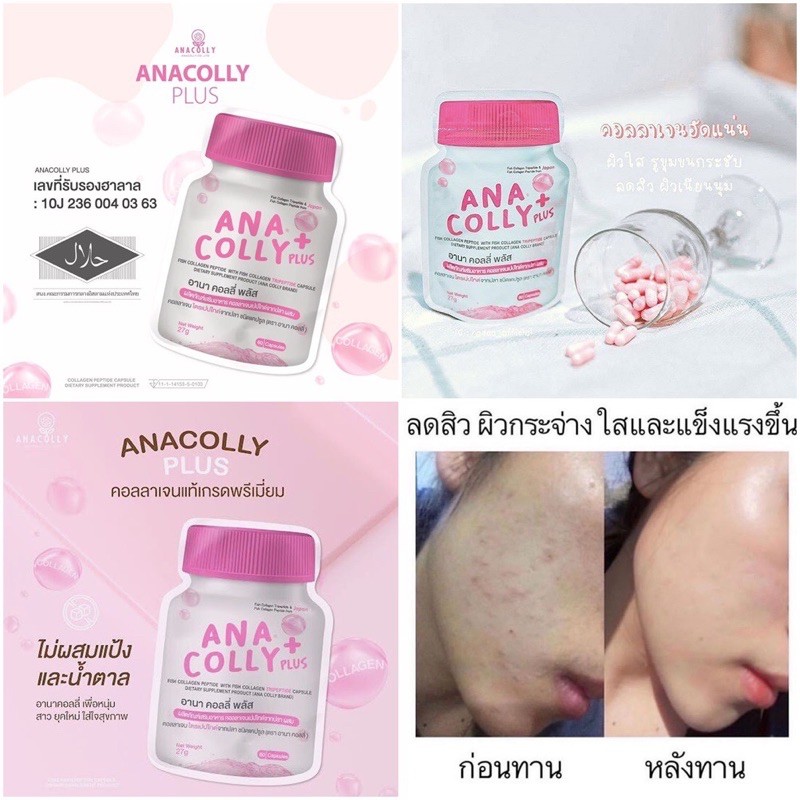 แท้?%? Anacolly Plus Collagen ? <3 แถม 1> ana colly อนาคอลลี่ คอลลาเจน อานาคอลลี่พลัส คอลลาเจนเพียว