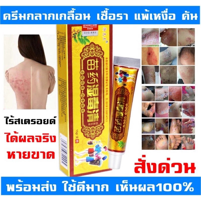 แฟงโก้-บี ครีม 15กรัม Fango-B cream เชื้อรา กลาก เกลื้อน น้ำกัดเท้า ...