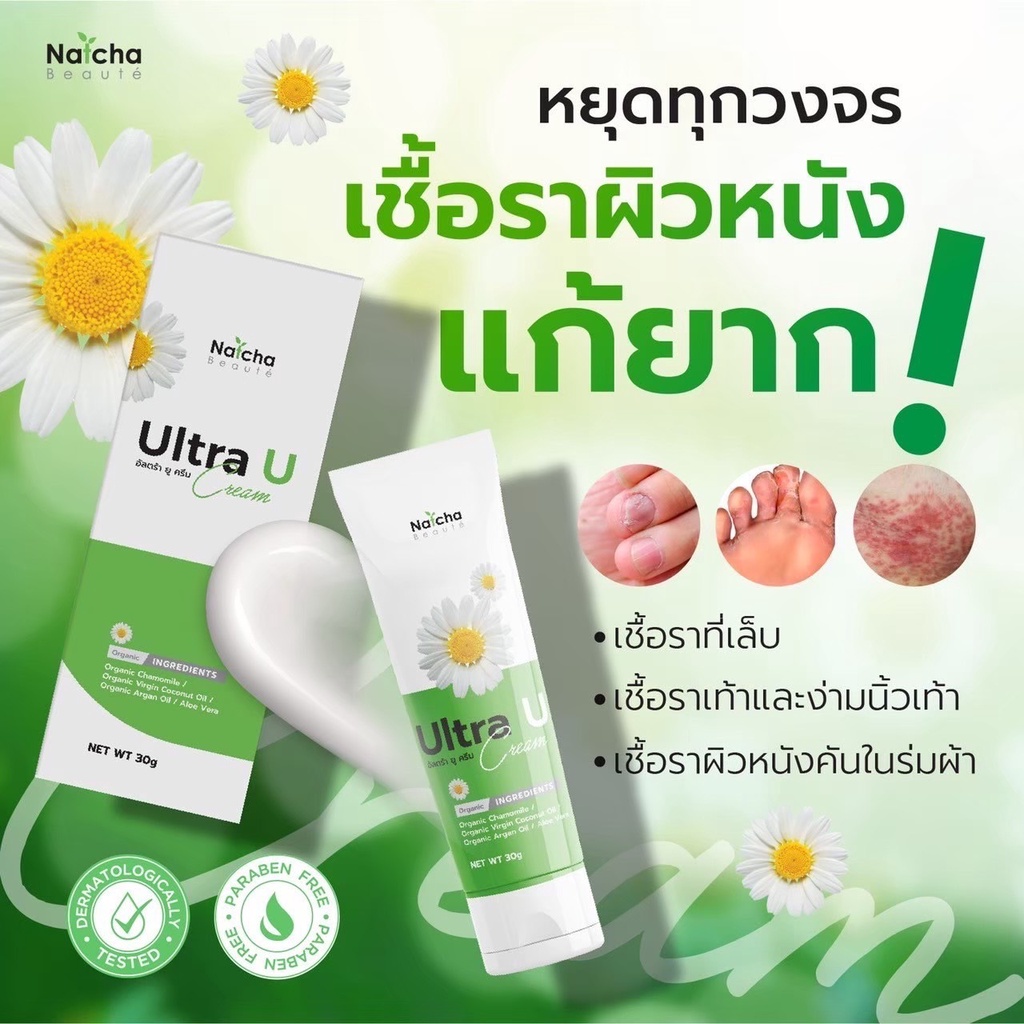 ส่งฟรี​ มีโปรแถม​ Ultra U อัลตร้ายู ครีม ครีมทาเชื้อรา ผิวหนัง คัน ร่มผ้า แก้ปัญหาเชื้อรา เล็บเน่า มีกลิ่น ลดอาการคัน