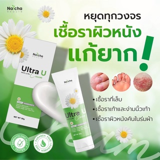 🔥ส่งฟรี​ มีโปรแถม​🔥Ultra U อัลตร้ายู ครีม ครีมทาเชื้อรา ผิวหนัง คัน ร่มผ้า แก้ปัญหาเชื้อรา เล็บเน่า มีกลิ่น ลดอาการคัน