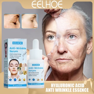 Eelhoe Hyaluronic Acid เอสเซ้นเซรั่มบํารุงผิวหน้า ต่อต้านริ้วรอย ให้ความชุ่มชื้น กระชับรูขุมขน ลดเลือนริ้วรอย ลดเลือนจุดด่างดํา ขนาด 30 มล.