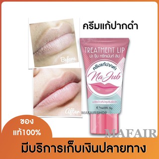 ครีมแก้ปากดำ Na Jub Treatment Lip น่าจุ๊บลิปแก้ปากดำคลีนิค พร้อมทั้งบำรุงให้ริมฝีปากชุ่มชื้น ขนาด 5g. (1 หลอด)