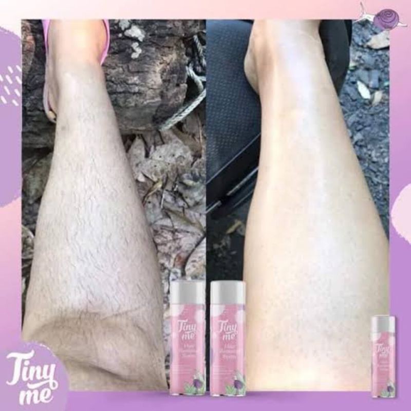 มูสเปรย์กำจัดขนTiny me Hair Removal Spray มูสกำจัดขน - รูปที่ 3