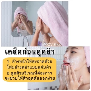 DERMASUCTION เครื่องดูดสิวสูญญากาศ ดูดสิวเสี้ยน สิวอุดตัน สิวหัวดำ จุดดำสิวที่จมูก / 1 เครื่อง