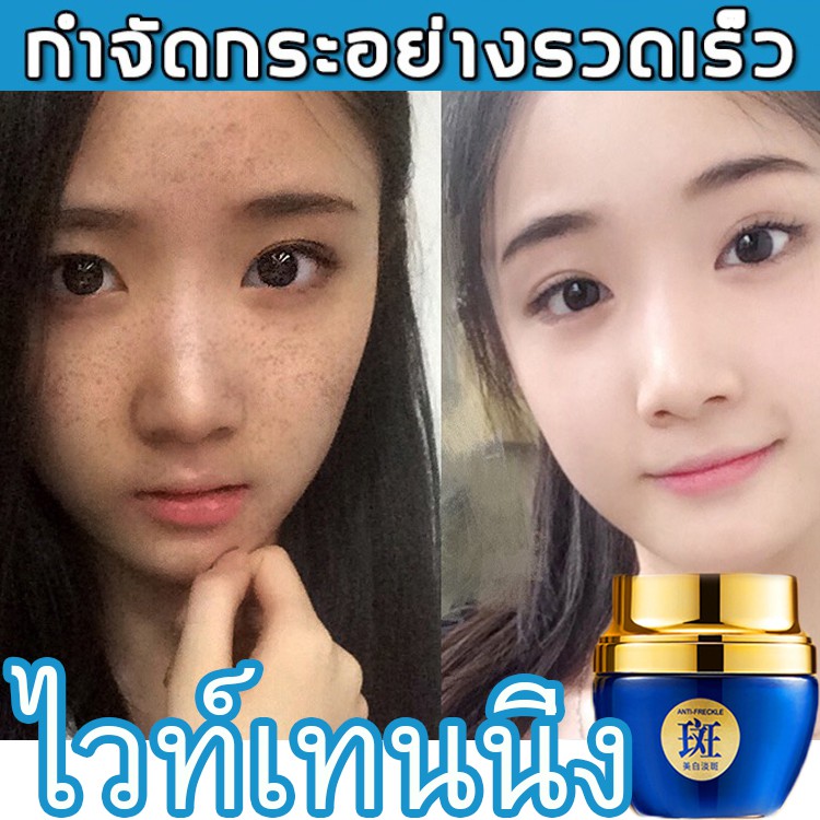 (เห็นผลเร็ว/ของแท้) VENZEN Whitening Anti-Freckle Cream ครีมทาฝ้า ครีมไวท์เทนนิ่ง ลดฝ้า กระ จุดด่างด