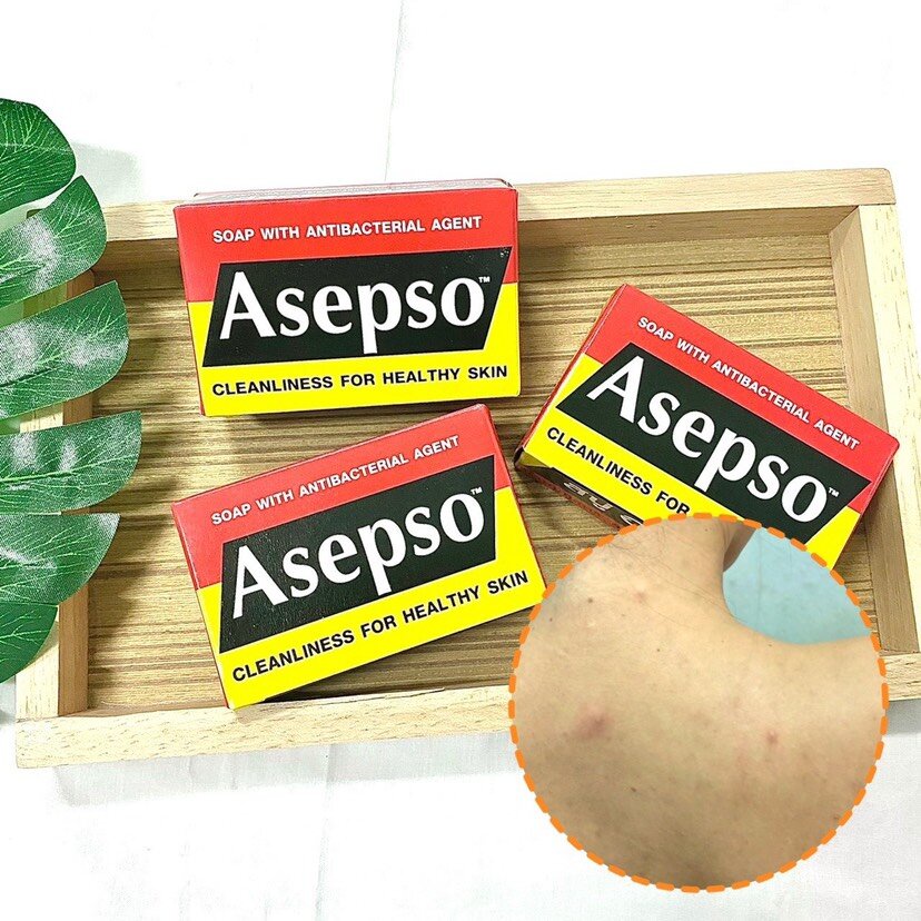 สบู่ อาเซปโซ่  Asepso ลดแบคทีเรีย บำรุงผิวเห็นผลตั้งแต่ก้อนแรก