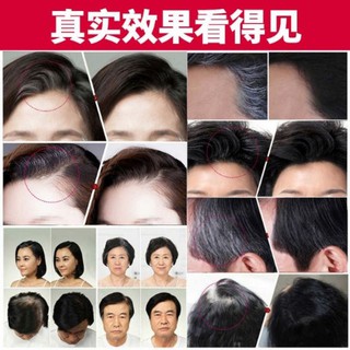 ลิปปิดผมขาว ปิดผมหงอบให้ดกดำอีกครั้ง